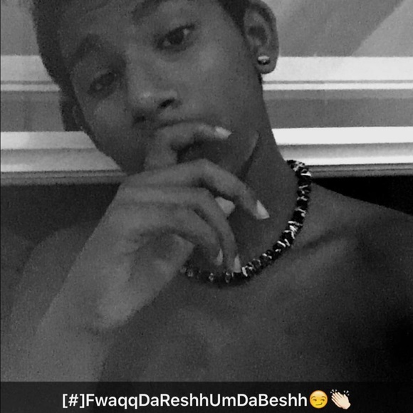 trapz_killer
