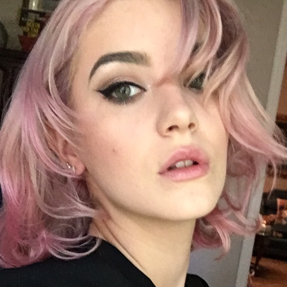 missfreckels