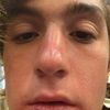 mitch5744