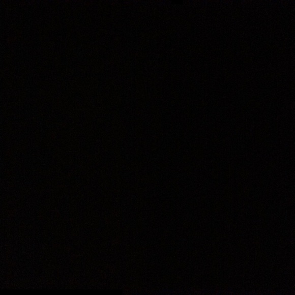 anthonydimples