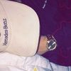 tommydis