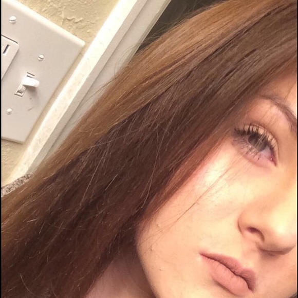 cassi32rad