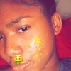 m_dimples