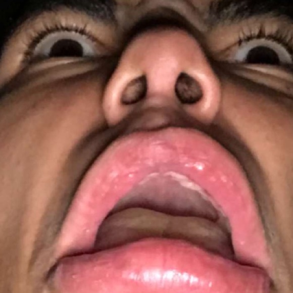 superrradical