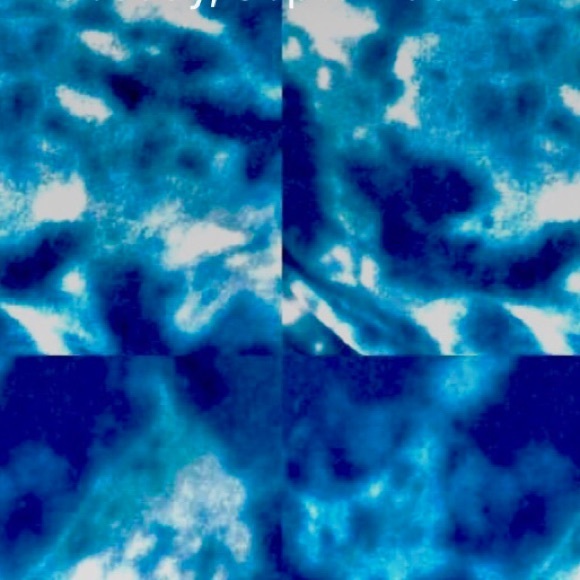 blakebridges_