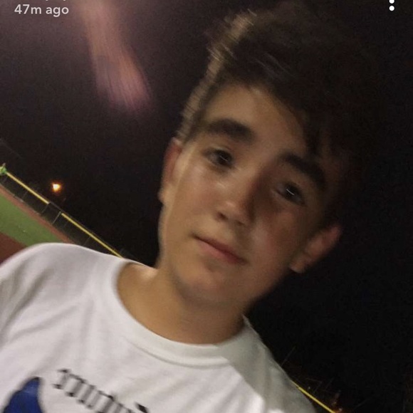 lui_bald