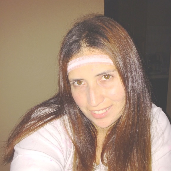 almis8
