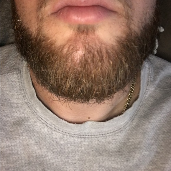 ndferrante