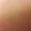 alliepineapple